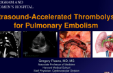 Ultrasound-Accelerated Thrombolysis for Pulmonary Embolism