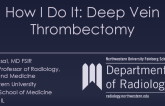How I Do It: Deep Vein Thrombectomy