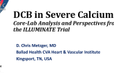DCB in Severe Calcium: Core-Lab Analysis and Perspectives from the ILLUMINATE Trial