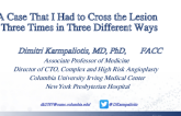 A Case That I Had to Cross the Lesion Three Times in Three Different Ways