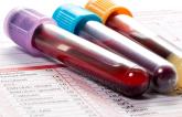 NT-proBNP Test Could Help Guide Hypertension Therapy: ARIC Analysis