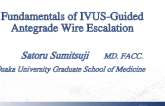 Fundamentals of IVUS-Guided Antegrade Wire Escalation
