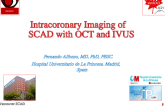 Intracoronary Imaging of SCAD with OCT and IVUS