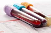 Papers Confirm Rare Thrombocytopenia Link to AstraZeneca Vaccine