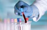 VTE Risk Higher After Oxford/AstraZeneca COVID-19 Vaccine, Study Affirms