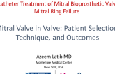Mitral Valve in Valve: Patient Selection, Technique, and Outcomes