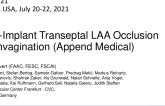 Non-Implant Transeptal LAA Occlusion by Invagination (Append Medical)