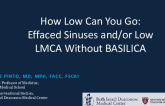 How Low Can You Go? Low Left Main and/or Effaced Sinus Without Basilica