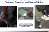 Between a Rock and a Hard Place: Calcium, Calcium, and More Calcium