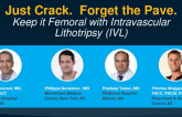 IVL and how it can assist your quest to stay femoral
