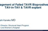 Management of Failed TAVR Bioprostheses: TAV-in-TAV and Surgical TAVR Explanation