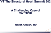 A Challenging Case of ViV TMVR