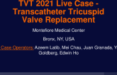 Live Case #17:  Montefiore Medical Center  New York City