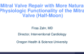 Mitral Valve Repair With More Natural Physiologic Functionality of the Mitral Valve (Half-Moon)