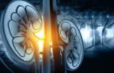 Renal Denervation a Third Option for Hypertension, European Experts Say