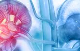 NSTEMI Patients With CKD See Better Outcomes With Invasive Strategy