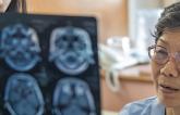 Predictors of AF May Help Guide Care After Stroke of Unknown Cause