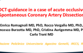 TCT 627: OCT-Guidance in a Case of Acute Occlusive Spontaneous Coronary Artery Dissection