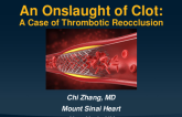 TCT 626: An Onslaught of Clot: A Case of Thrombotic Reocclusion