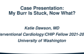 Case Presentation: My Burr Is Stuck, Now What?