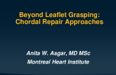 Chordal Repair Approaches (Harpoon, Pipeline, Chordart, Neochord, CardioMech)
