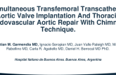 TCT 529: Simultaneous Transfemoral Transcatheter Aortic Valve Implantation And Thoracic Endovascular Aortic Repair With Chimney Technique.