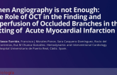 TCT 512: When Angiography is not Enough: The Role of Optical Coherence Tomography in the Finding and Reperfusion of Occluded Branches in the Setting of Acute Myocardial Infarction