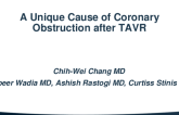 TCT 613: A Unique Cause of Coronary Obstruction After Transcatheter Aortic Valve Replacement