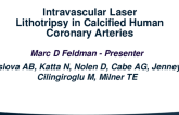 Laser Balloon Calcium Fracture in Calcified Human Coronary Arteries