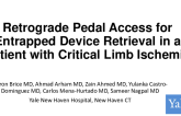 TCT 678: Retrograde Pedal Access for Entrapped Device Retrieval in a Patient With Critical Limb Ischemia