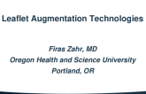 Leaflet Augmentation Technologies (Half-Moon, Polares, Dura-Sutra)
