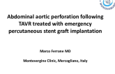 TCT 527: Abdominal Aortic Perforation Following TAVR Treated With Emergency Percutaneous Stent Graft Implantation