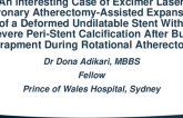 TCT 652: An Interesting Case of Excimer Laser Coronary Atherectomy-Assisted Expansion of a Deformed Undilatable Stent With Severe Peri-Stent Calcification After Burr Entrapment During Rotational Atherectomy