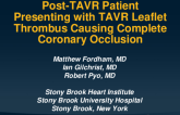 TCT 653: Post-TAVR Patient Presenting With TAVR Leaflet Thrombus Causing Complete Coronary Occlusion