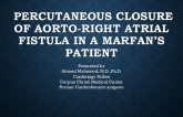 TCT 685: Percutaneous Closure of Aorto-Right Atrial Fistula: an Interesting Case of Marfan’s Syndrome and Fistula Formation