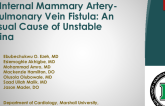 TCT 639: Left Internal Mammary Artery-to-Pulmonary Vein Fistula: An Unusual Cause of Unstable Angina