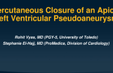 TCT 618: Percutaneous Closure of an Apical Left Ventricular Pseudoaneurysm