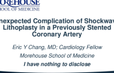 TCT 589: Unexpected Complication of Shockwave Lithoplasty in a Previously Stented Coronary Artery