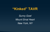 TCT 532: Kinked TAVR