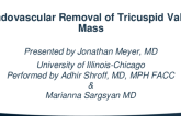 TCT 705: Endovascular Removal of Tricuspid Valve Mass 