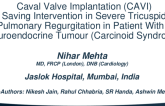 TCT 599: Caval Valve Implantation (CAVI) as a Life Saving Intervention in Severe Tricuspid and Pulmonary Regurgitation in Patient With a Neuroendocrine Tumour (Carcinoid Syndrome) 
