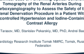 TCT 633: A Clinical Case of Performing Optical CoherenceTomography of the Renal Arteries During Carboxyangiography to Assess the Safety of the Renal Denervation Procedure in a Patient With Uncontrolled Hypertension and Iodine-Containing Contrast Allergy.