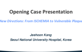 Case Presentation 1  Case: Vulnerable Stenosis by CTA, but FFR Negative or Borderline (From Dr. Koo); Vulnerable Stenosis by OCT/IVUS/NIRS/s Ischemia (From Dr. Erlinge)