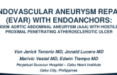 TCT 520: Endovascular Aneurysm Repair (EVAR) With Endoanchors: For Tandem Aortic Abdominal Aneurysm (AAA) With Hostile Neck & Proximal Penetrating Atherosclerotic Ulcer
