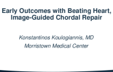 Early Outcomes with Beating Heart, Image-Guided Chordal Repair