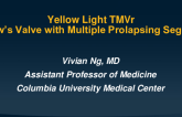 Case 3: Yellow Light TMVr – Barlow’s Valve With Multiple Prolapsing Segments