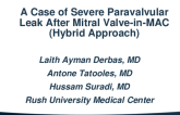 TCT 580: A Case Of Severe Paravalvular Leak After Mitral Valve-In-MAC Using Edwards Sapien 26mm Valve And A Hybrid Approach