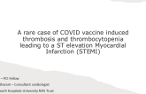 TCT 513: A Rare Case Of COVID Vaccine Induced Thrombosis And Thrombocytopenia (VITT) Leading To a ST Elevation Myocardial Infarction (STEMI)