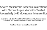 TCT 560: Severe Mesenteric Ischemia in a Patient With Chronic Lupus Vasculitis Treated Successfully by Endovascular Intervention