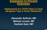 TCT 525: Expansion to Prevent Extension: Deployment of TAVR Valve to Treat Iatrogenic Type A Aortic Dissection